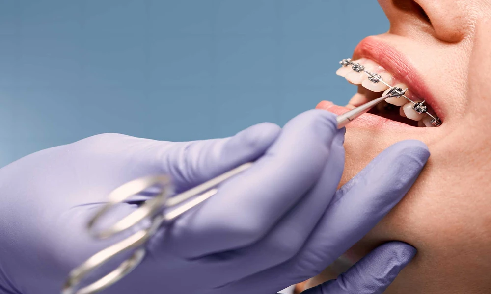 Why Tooth Translucency Matters In Cosmetic Dental Restorations